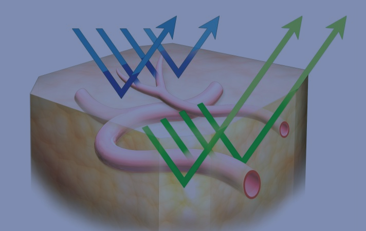 光デジタル法による先進画像技術