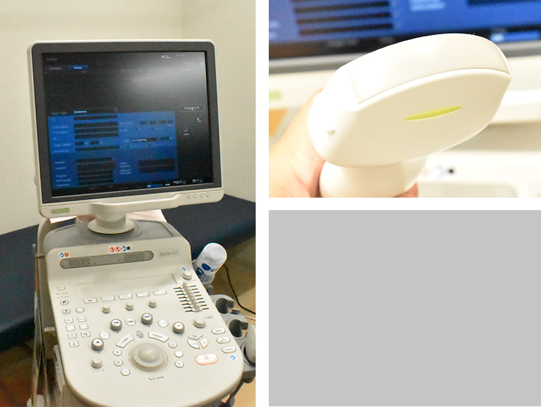 超音波診断装置 Canon Xario100S